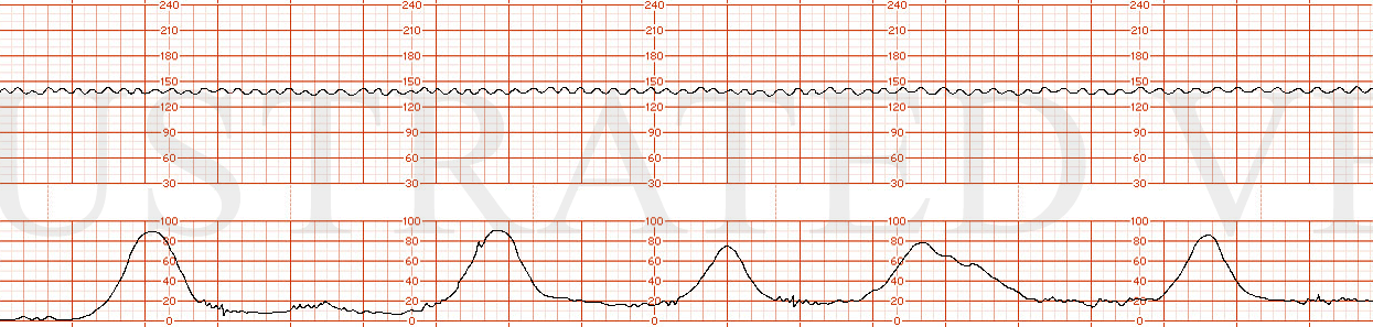 Illustrated Verdict, Inc.  DrGarite0225
