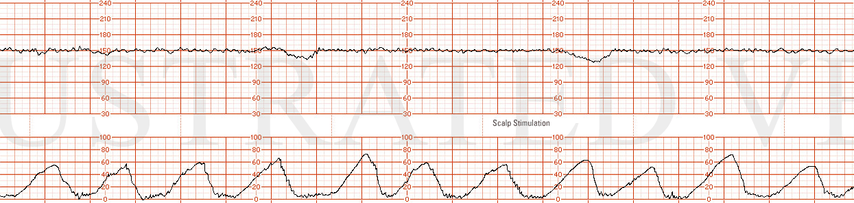 Illustrated Verdict, Inc.  DrDeppQ152