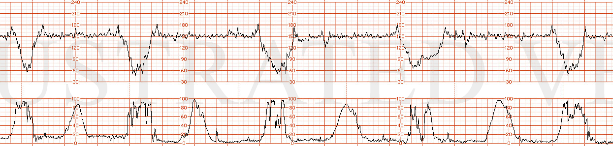 Illustrated Verdict, Inc.  DrBurgansky 0253