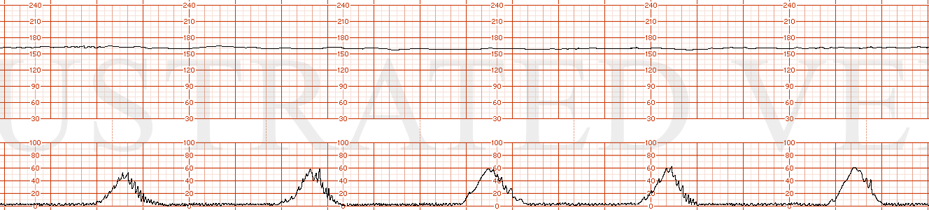 Illustrated Verdict, Inc.  04-Case35N