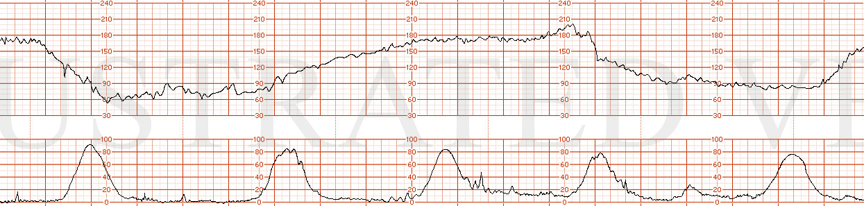 Illustrated Verdict, Inc.  DrGarite0203