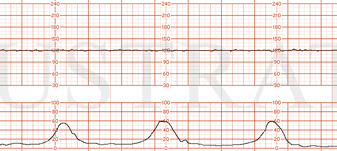 Illustrated Verdict, Inc.  mod-04-case42