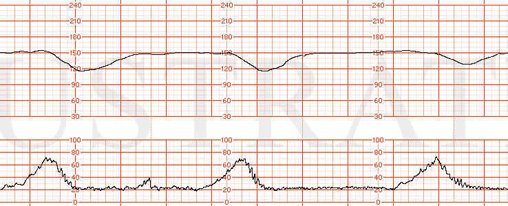 mod04Case44  Category III  Illustrated Verdict, Inc.