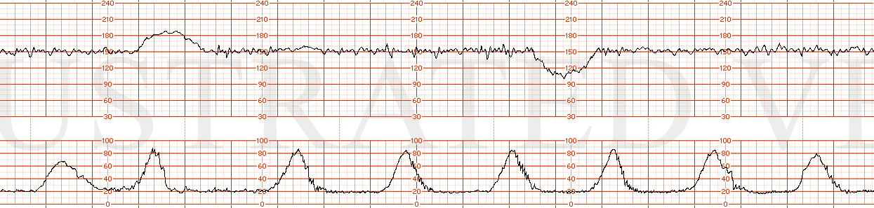Illustrated Verdict, Inc.  Cat II
