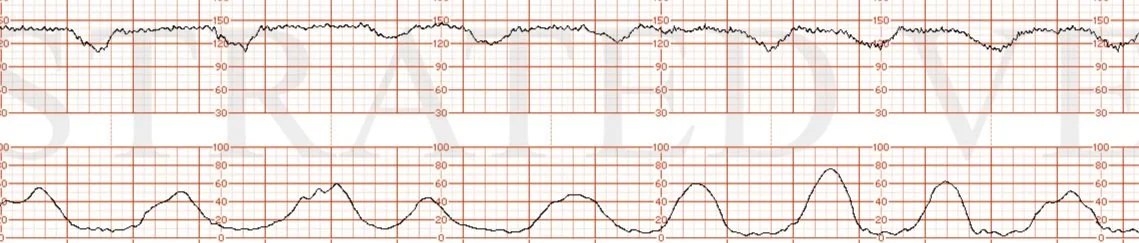 Electronic Fetal Monitoring: Management and Standard of Care Part 1 preview image